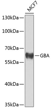 GBA Polyclonal Antibody (E-AB-62754)