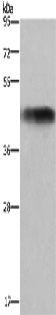 GALT Polyclonal Antibody (E-AB-15057)