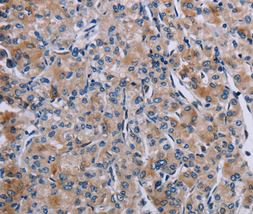 KDM4D Polyclonal Antibody (E-AB-11341)