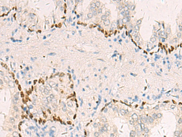 TP63 Polyclonal Antibody (E-AB-52639)