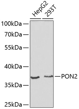 PON2 Polyclonal Antibody (E-AB-60392)