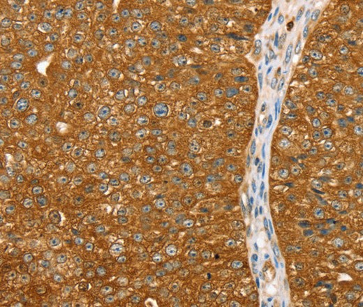 ABCC8 Polyclonal Antibody (E-AB-16893)