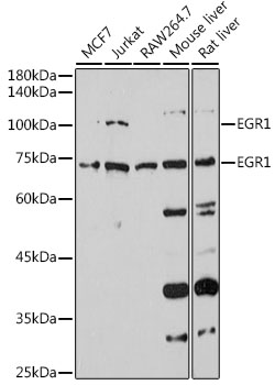 EGR1 Polyclonal Antibody (E-AB-93373)