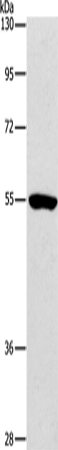 ANGPT2 Polyclonal Antibody (E-AB-10134)
