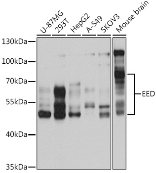 EED Polyclonal Antibody (E-AB-92642)