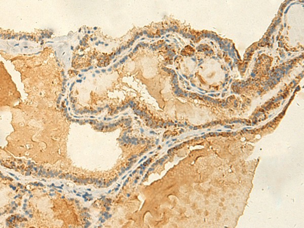 RNF148 Polyclonal Antibody (E-AB-52875)