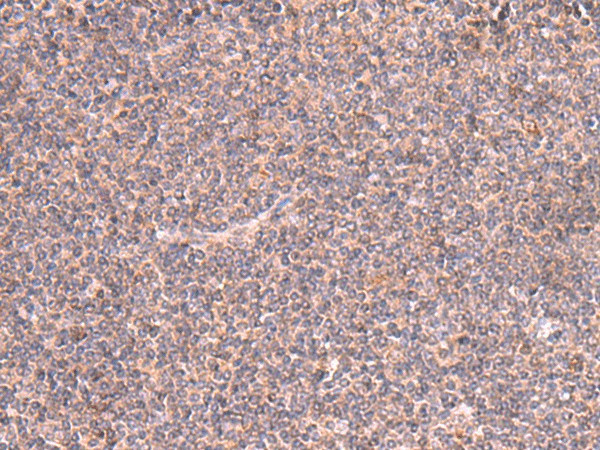 MRPS24 Polyclonal Antibody (E-AB-18786)