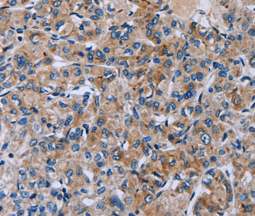HSD3B2 Polyclonal Antibody (E-AB-15114)