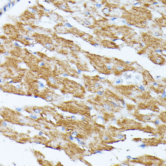 KCNJ15 Polyclonal Antibody (E-AB-65248)