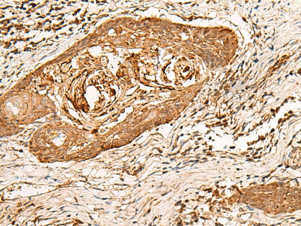 HIRIP3 Polyclonal Antibody (E-AB-52761)