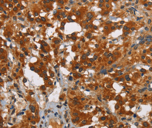 SMAD9 Polyclonal Antibody (E-AB-13068)