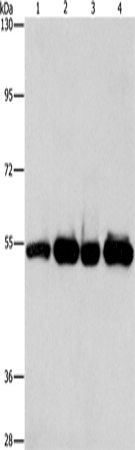 PDE4D Polyclonal Antibody (E-AB-10534)