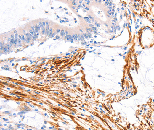 ARAP1 Polyclonal Antibody (E-AB-16175)