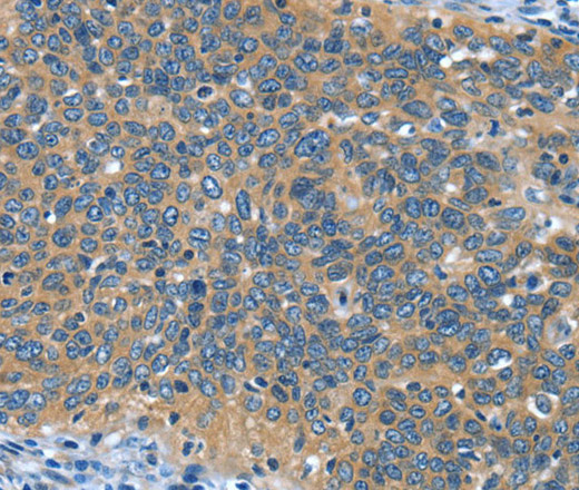 DTX1 Polyclonal Antibody (E-AB-13192)