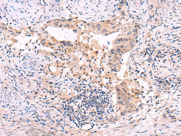 SLC12A5 Polyclonal Antibody (E-AB-18162)