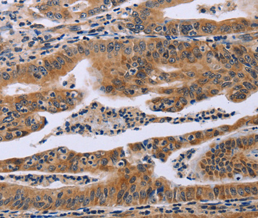 FAF1 Polyclonal Antibody (E-AB-12403)