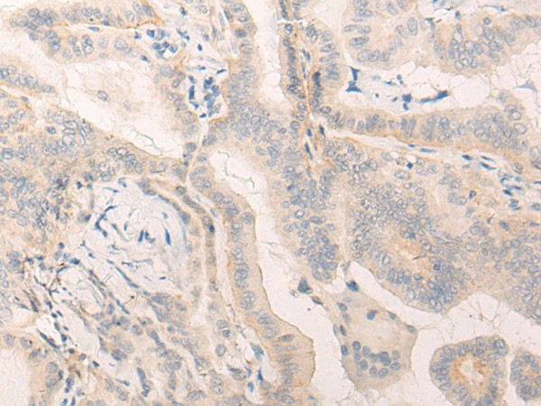 ELANE Polyclonal Antibody (E-AB-17904)