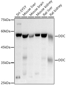 DDC Polyclonal Antibody (E-AB-92553)