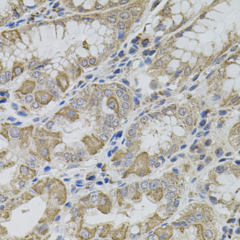 VIP Polyclonal Antibody (E-AB-64231)