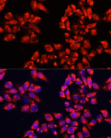 ALDH7A1 Polyclonal Antibody (E-AB-63890)