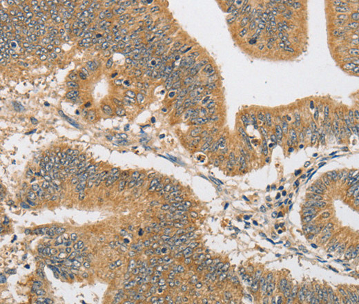 ARHGAP15 Polyclonal Antibody (E-AB-14604)