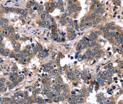 FGFR1OP2 Polyclonal Antibody (E-AB-15033)