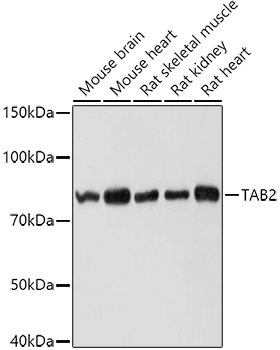 TAB2 Polyclonal Antibody (E-AB-93005)