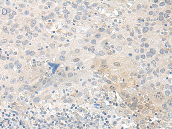 TUBG2 Polyclonal Antibody (E-AB-18724)
