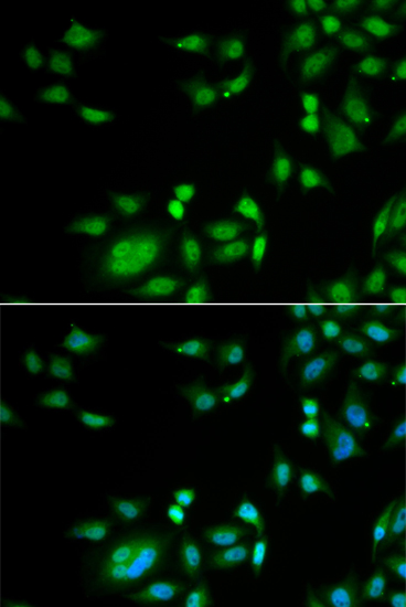 INTS10 Polyclonal Antibody (E-AB-64624)