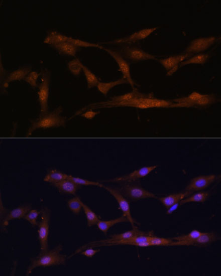 CBS Polyclonal Antibody (E-AB-60308)