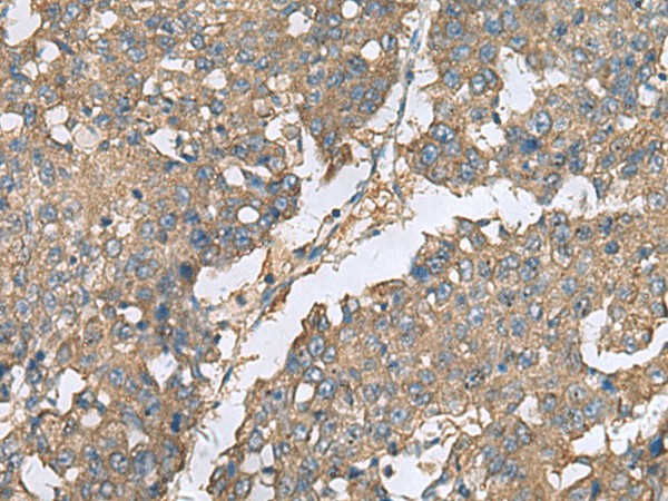 EIF1AX Polyclonal Antibody (E-AB-19124)