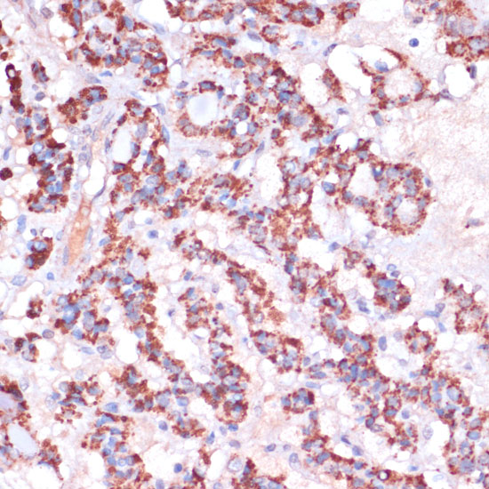 MRPL23 Polyclonal Antibody (E-AB-66811)