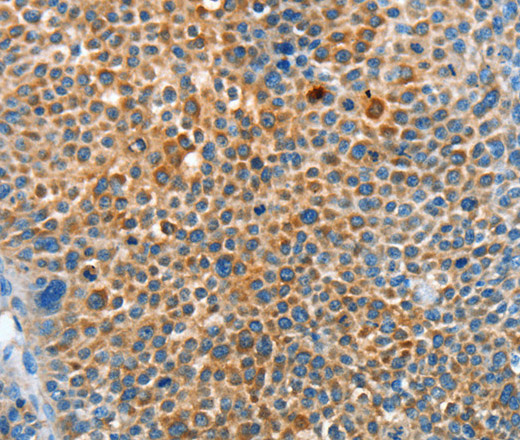 SERPINF2 Polyclonal Antibody (E-AB-16155)