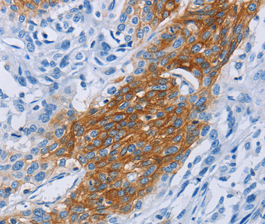 CCR9 Polyclonal Antibody (E-AB-11039)