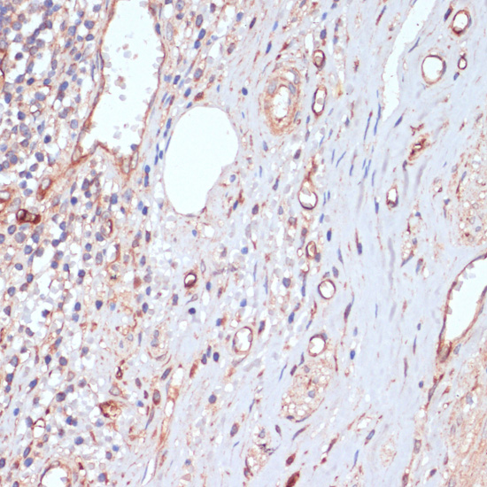 CD34 Polyclonal Antibody (E-AB-60105)