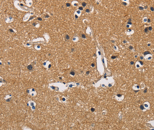 CBY1 Polyclonal Antibody (E-AB-10937)
