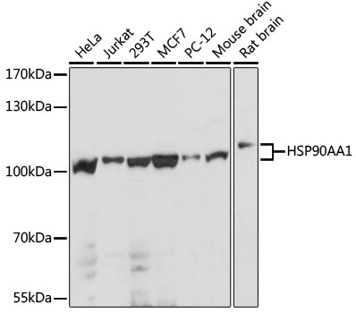 HSP90AA1 Polyclonal Antibody (E-AB-65909)