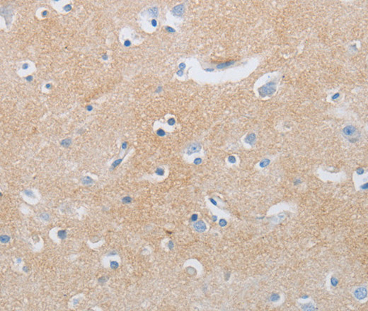 CD10 Polyclonal Antibody (E-AB-15992)