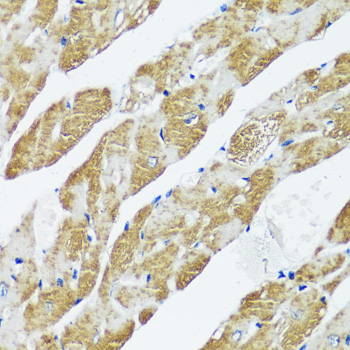 CASQ2 Polyclonal Antibody (E-AB-66943)