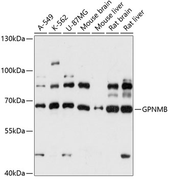 GPNMB Polyclonal Antibody (E-AB-90777)