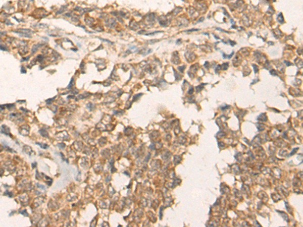 ATR Polyclonal Antibody (E-AB-53308)
