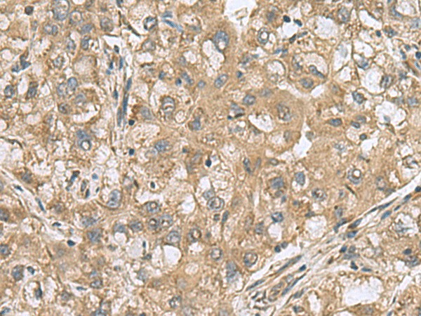 PAPSS2 Polyclonal Antibody (E-AB-19076)