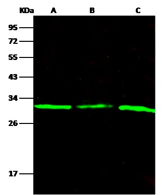 Recombinant Purine nucleoside phosphorylase/PNP Monoclonal Antibody (AN300415P)
