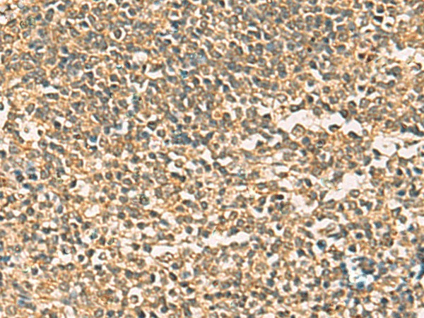 THG1L Polyclonal Antibody (E-AB-53131)