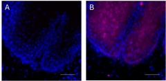 Purified anti-MRP-14 (S100A9) Antibody (648820)