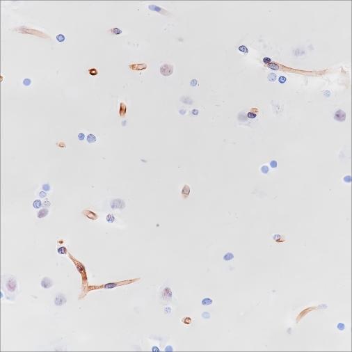 Recombinant Nestin Monoclonal Antibody (AN301610L)