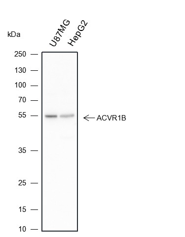 Recombinant Activin A Receptor Type IB/ALK-4 Monoclonal Antibody (AN301427L)