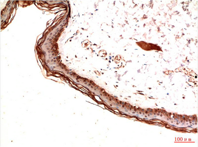 PDGFRA Monoclonal Antibody (E-AB-22143)
