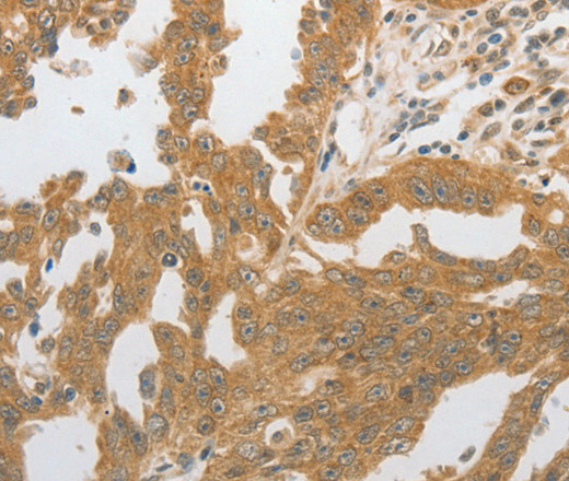 GRIN2C Polyclonal Antibody (E-AB-15808)