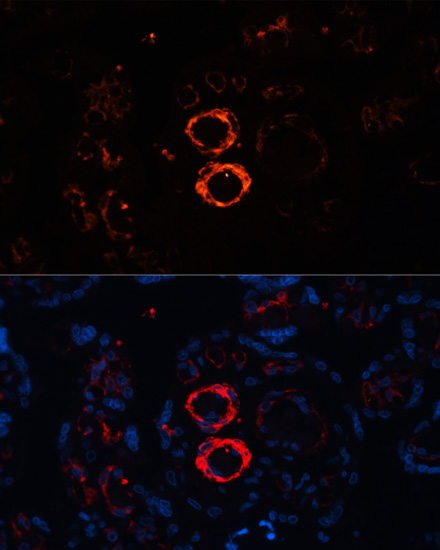 MYH11 Polyclonal Antibody (E-AB-63464)